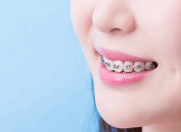 dis-telleri-taktirmadan-once-yapilmasi-gerekenler-belgintarim-bodrum