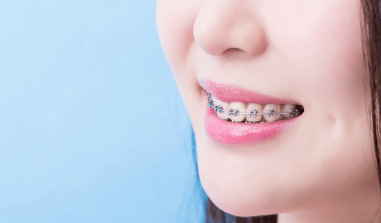 dis-telleri-taktirmadan-once-yapilmasi-gerekenler-belgintarim-bodrum